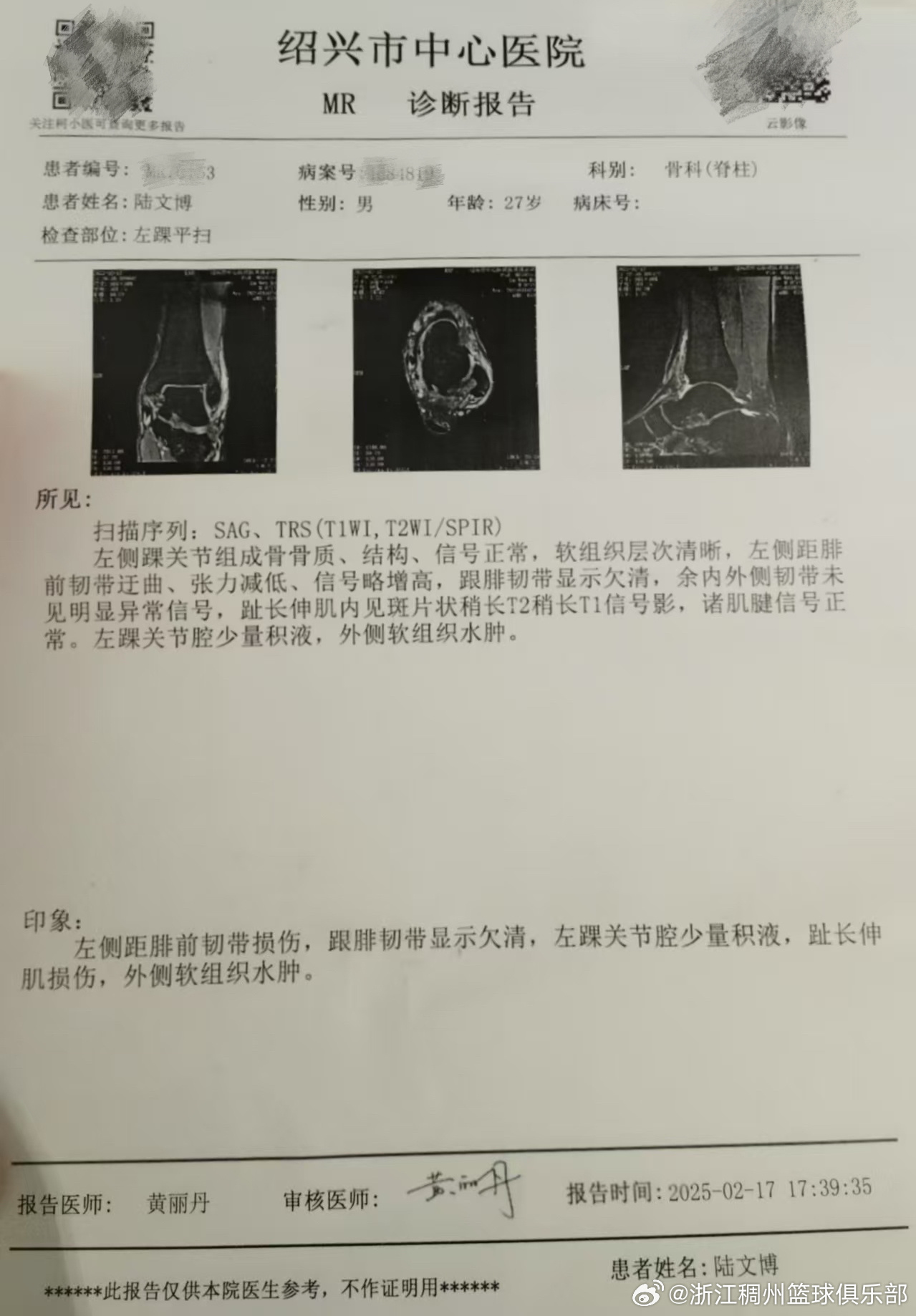 线投射和坚